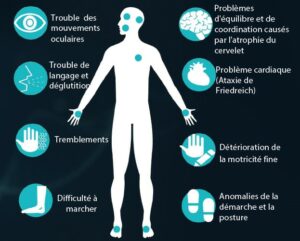 Lire la suite à propos de l’article Le syndrome cérébelleux, le diagnostic